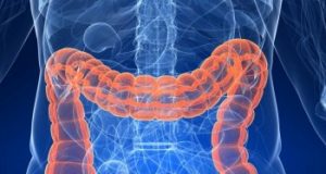 Месец март – Световен месец за борба с рака на дебелото черво