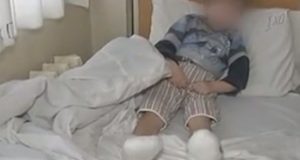 Месец след инцидента детето с премръзналите крайници вече тича и играе