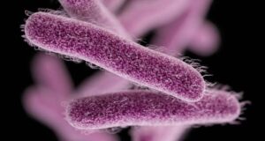 Случай на шигелоза установиха в Павликени